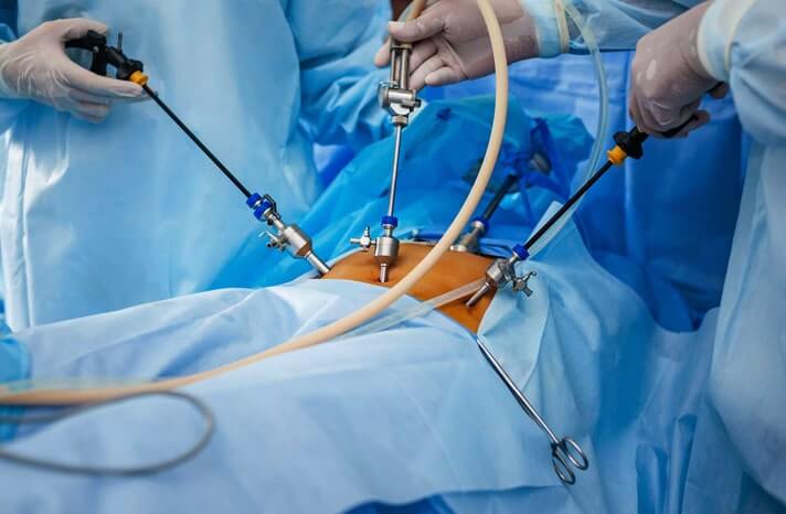 Laparoscopic Urology