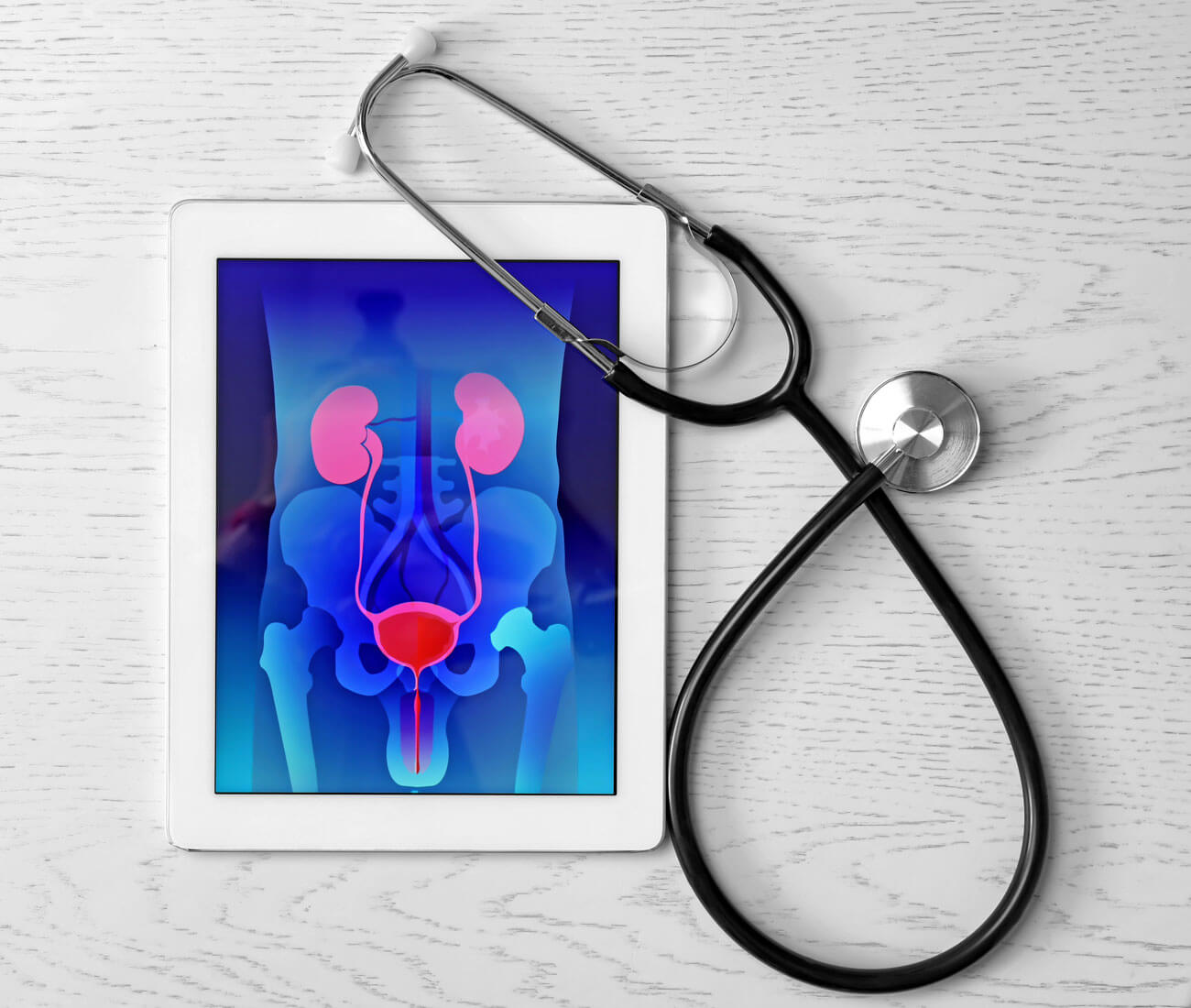 urology-treatment-delhi